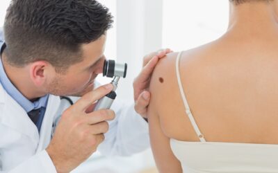 Mappatura nevi a Milano: contatta lo Studio Dermatologico Bianchi