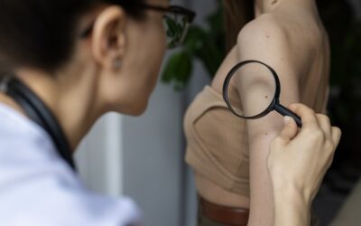 Screening del cancro della pelle: quando, come e perché